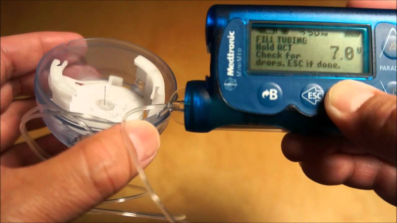 medtronic mio infusion set medtronic mio infusion set