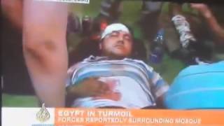 Injured Egyptian Brotherhood cought with fake wound - Moslim Broeder gesnapt met nep wond