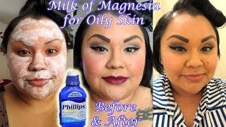 What are the side effects of milk of magnesia?