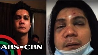 Shocking Photos of Vhong Navarro after The Fort attack