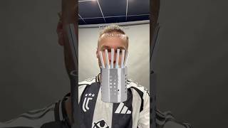 Koop is unlucky 😭? #juventus