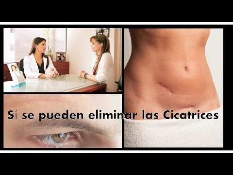 La crema para uvelecheniya del miembro