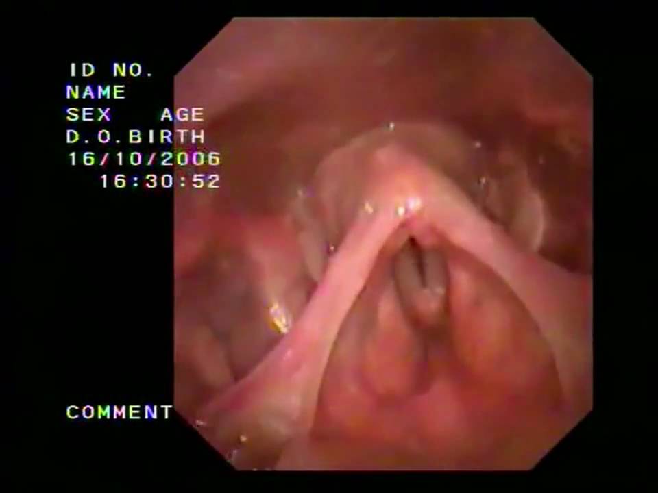 Mal Webb's Larynx in Hamburg - YouTube