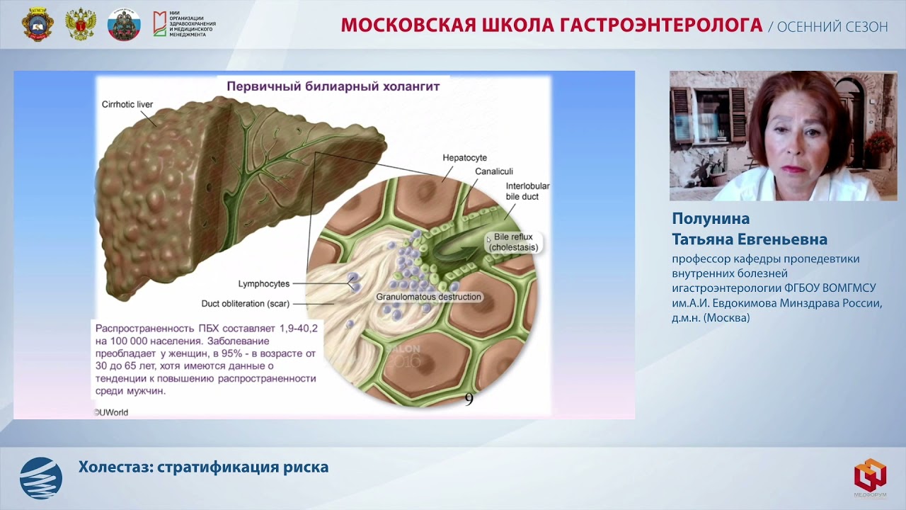 Первичный билиарный холангит презентация