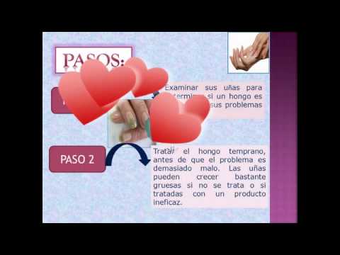 El hongo sobre los dedos de los pies de la consecuencia