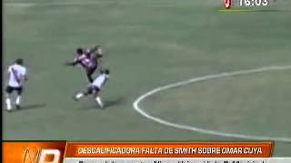 Terrible Intervention on the head in peru second division | 16/07/2013