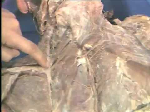 Gross Anatomy: Superficial and Deep Back Muscles - YouTube