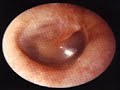 Eye, Ear, Nose, & Throat Examination