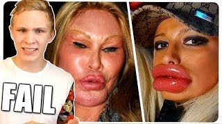 BOTOX FAILS! Schönheits-OP & Plastische Chirurgie Disaster