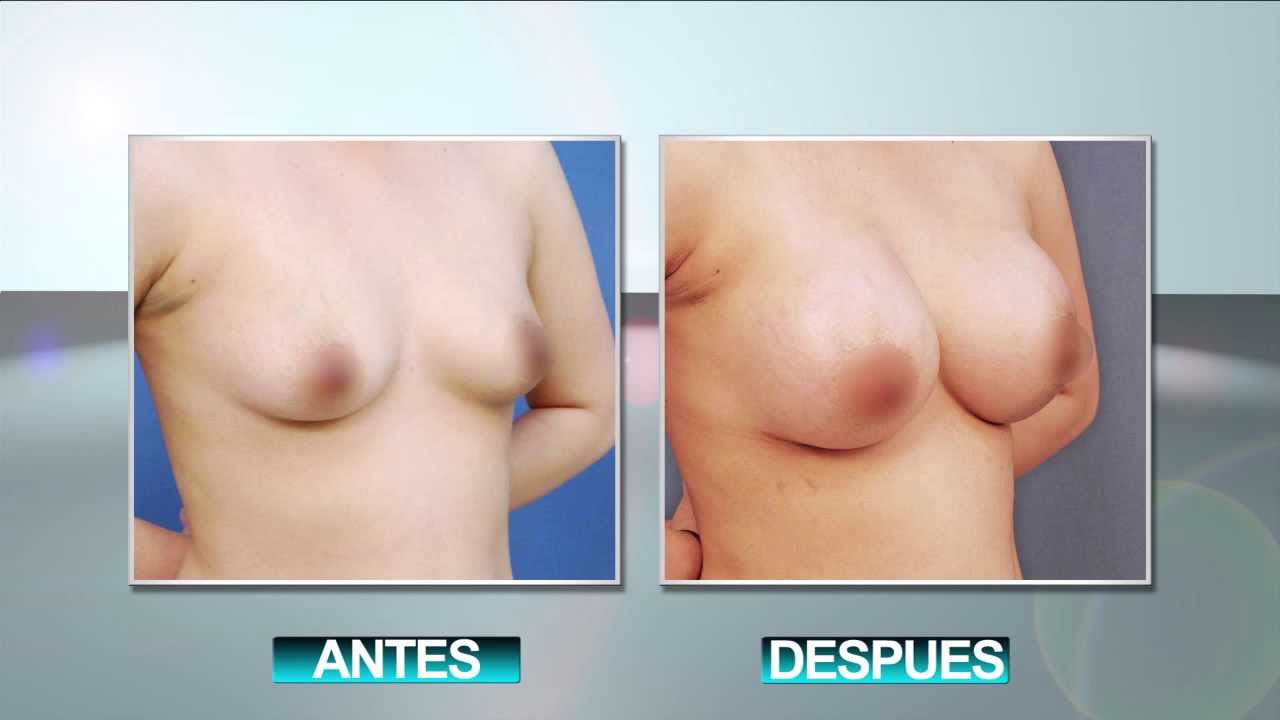 Como aumentar el pecho al niño