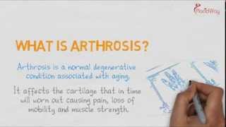 Watch Video Understand Arthritis vs Arthrosis