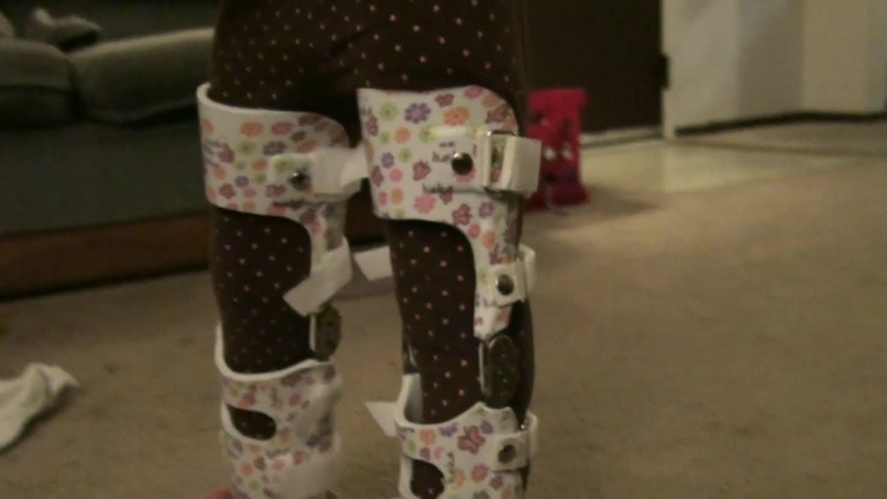 Putting On My Daughters New Leg Braces (and walking update!) YouTube