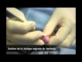 castration chat