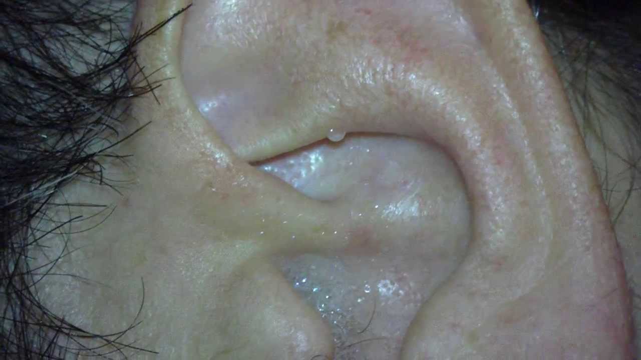 Remedio contra la gripe INFALIBLE ocultado por las Remedio contra la gripe INFALIBLE ocultado por las