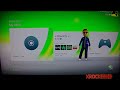 Thumbnail 1 for How To Fix Xbox 360 Open Tray Error Without Opening Up Thumbnail 1 for How To Fix Xbox 360 Open Tray Error Without Opening Up