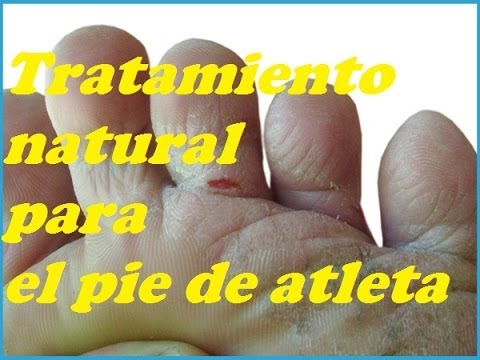 La crema para las uñas del hongo barato
