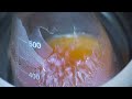 Freeze-drying Jello gelatin with an improved cold trap