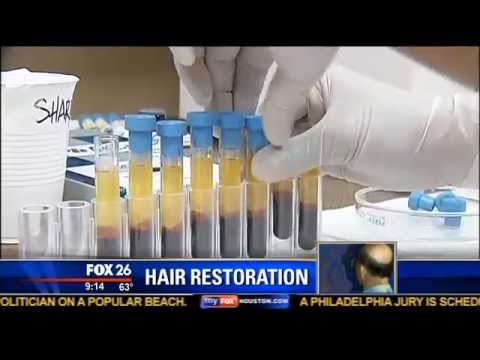 ACell + PRP Stem Cell Hair Regrowth Treatment | Houston Hair Surgeon Dr. Dan McGrath