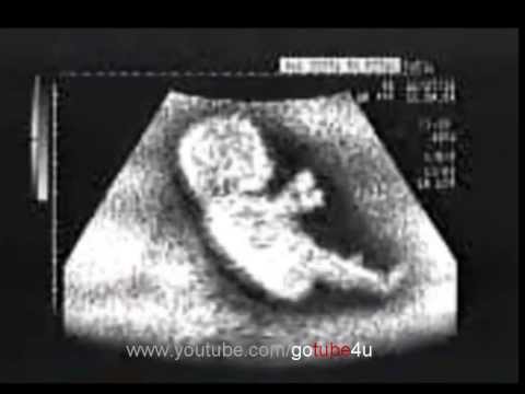 See what works Baby inside his mother's womb | funny video