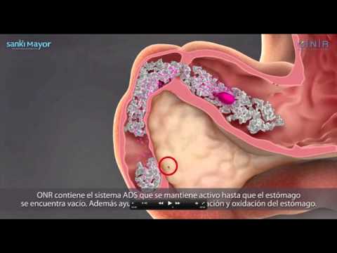 SANKI - Explicación de KRONUIT por el Dr. Alejandro Ariza SANKI - Explicación de KRONUIT por el Dr. Alejandro Ariza