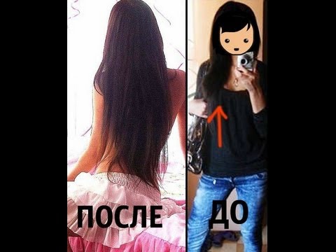 какие лекарства пить для роста волос Какие лекарства пить для роста волос недешево