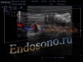 Нажмите для просмотра : Киста мениска коленного сустава