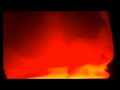 8 Hours Sleep Hypnosis for Depression Anxiety Self Confidence Emotional Healing