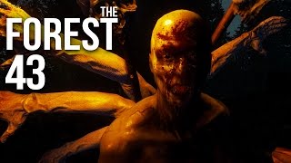 THE FOREST [HD+] #043 - Der Zaun-König ★ Let's Play The Forest