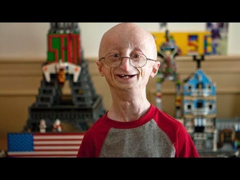 Hình ảnh trong video 17 Yr Old Kid Ages 8 Times Faster - Sam Berns