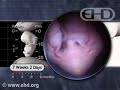 7 Weeks Pregnant -- Hiccups & Startle Response