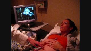 Mom To Be Finds Out That She Is Having TWINS!!!