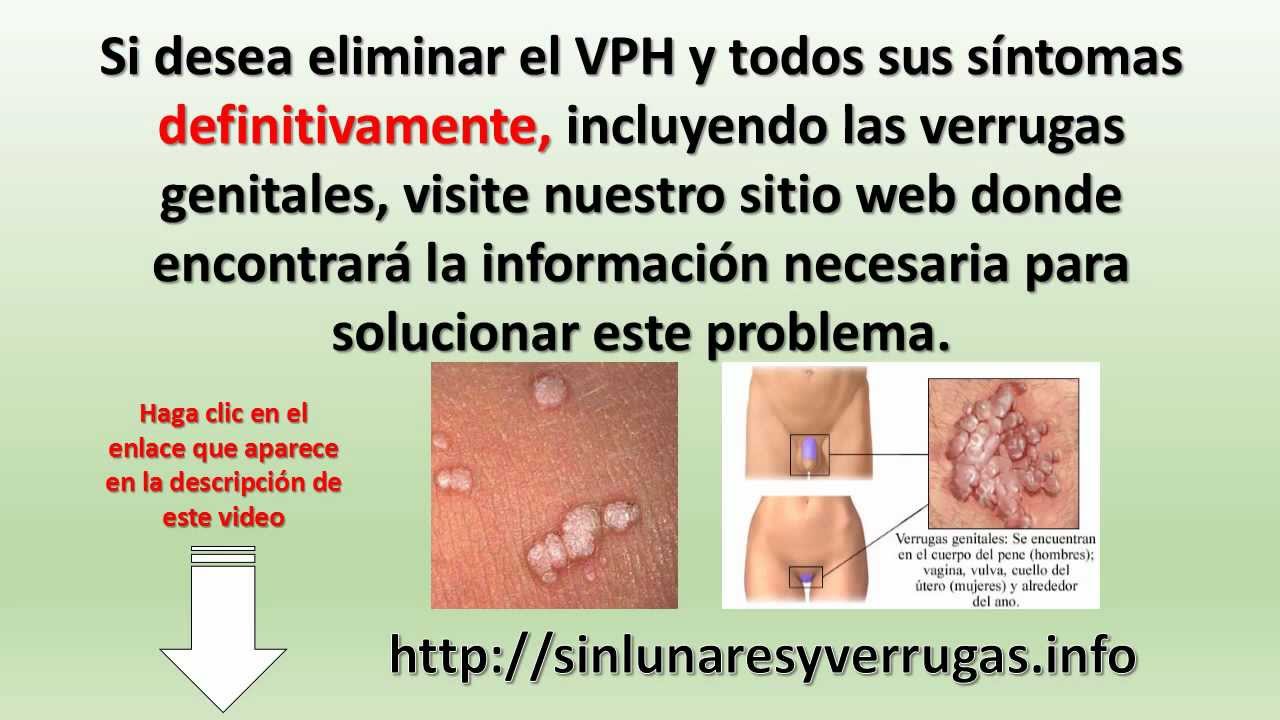 La eccema en el cuerpo a los niños