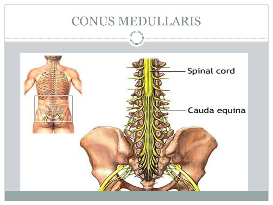 LOWER EXTREMITY IMPAIRMENTS SPINAL NERVE ROOTS CONUS MEDULLARIS www