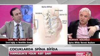Çocuklarda Spina Bifida 