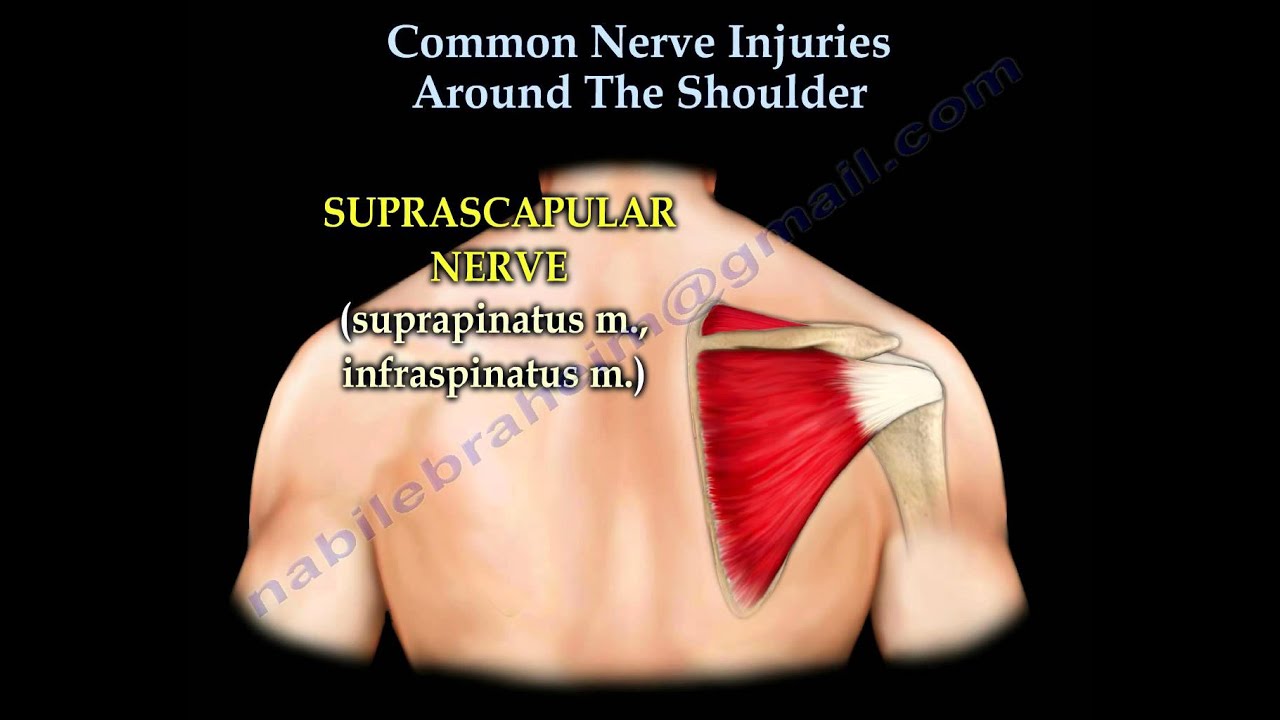 Shoulder Nerve injury ,Injuries - Everything You Need To Know - Dr