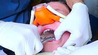 WARNING GRAPHIC DENTAL IMAGES!