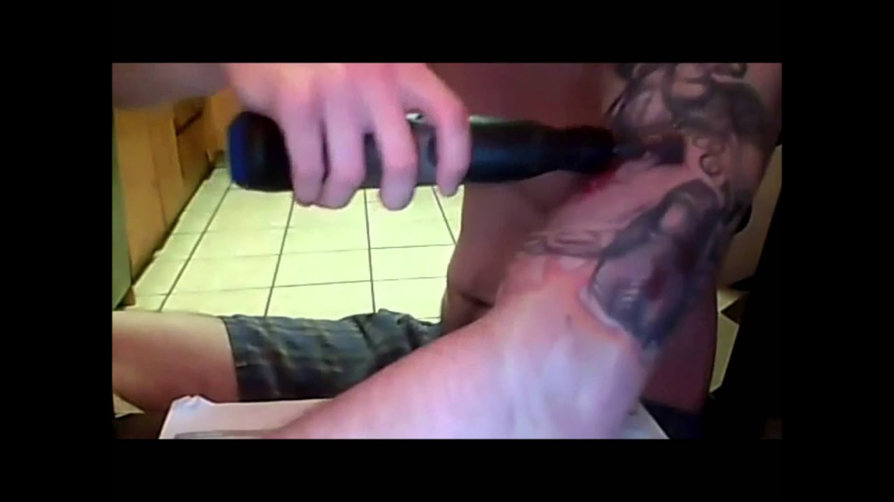 Tattoo Removal Cream Reviews - What Works and What Doesn't - YouTube