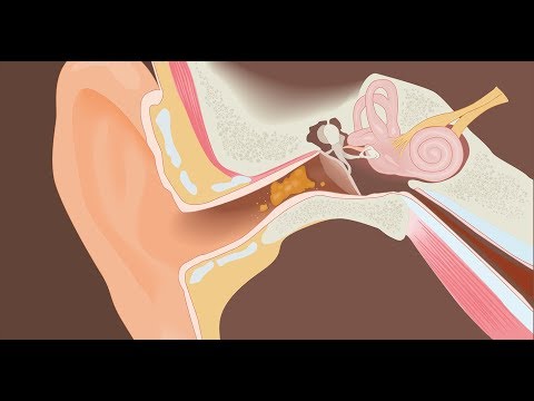 Как промывать ухо в домашних условиях шприцом 835
