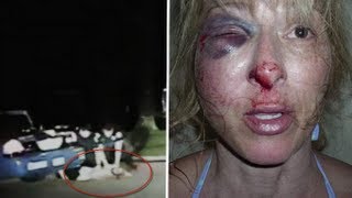 Police brutality: Tallahassee cops break Christina West's cheek in DUI stop