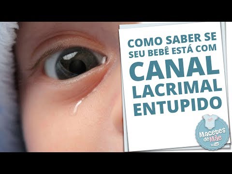 Canal Lacrimal Do Bebe Entupido O Que Fazer Canal Lacrimal Entupido E Como Tratar A Obstrucao