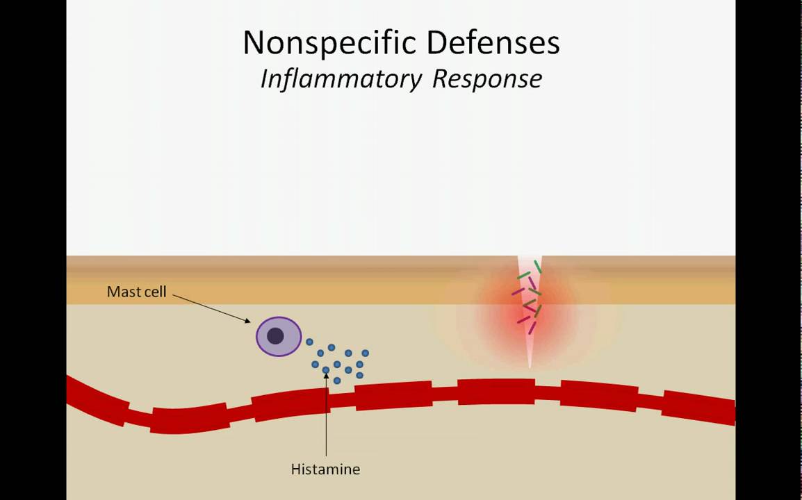 The Inflammatory Response - YouTube