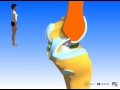 24 - arthro : genou