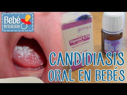 curare candida naturalmente