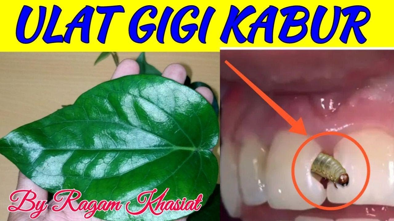 Ulat Gigi Cara Mengatasi Sakit Gigi Berlubang Tanpa Obat - malayhaha