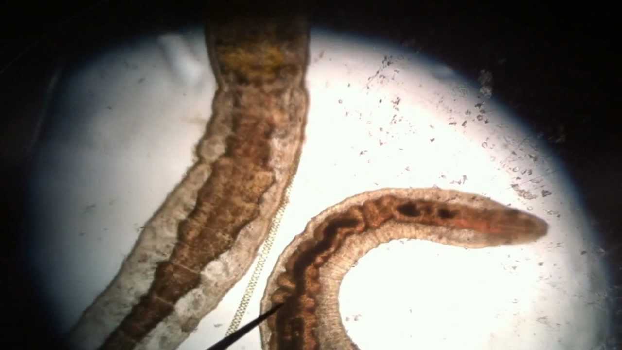 freshwater leech identification