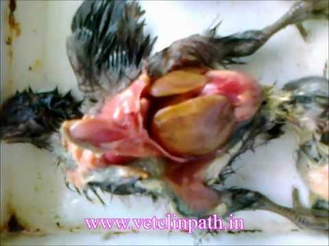 bronchitis infection home treatment