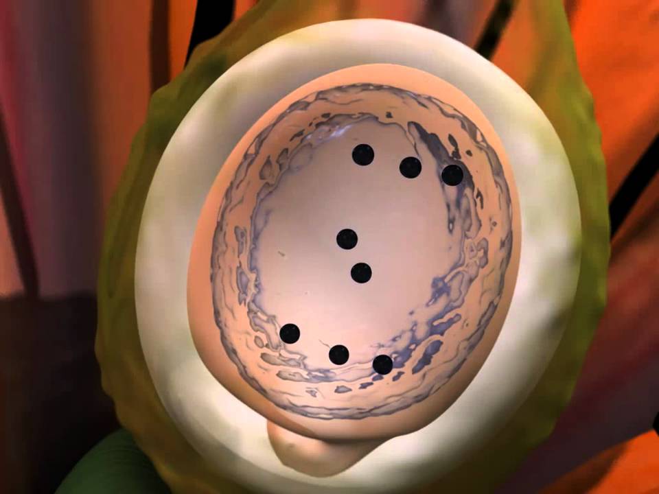 Double Fertilization in Angiosperms - YouTube