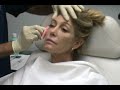 Video: The Rejuvalift from Rejuvalife Vitality Institute