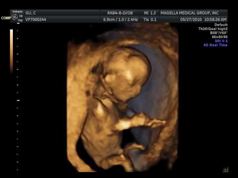 baby at 14 weeks 3d 4d ultrasound (1) - YouTube