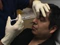 Video: 5 Minute Nose Job at Rejuvalife Vitality Institute
